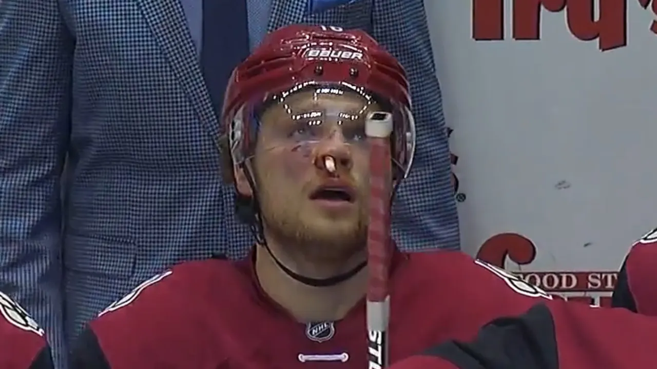 Toronto Maple Leafs center max domi sidelined indefinitely after post-season surgery issues - Article News sur NHL Insight