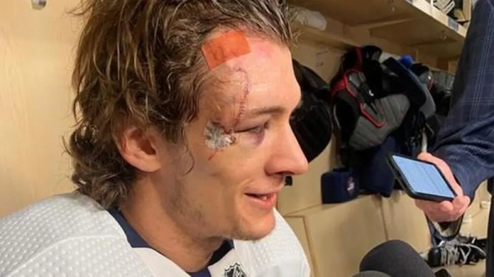 Morgan Barron Week-to-Week Injury Sidelights Jets Depth - Article Draft & Prospects sur NHL Insight