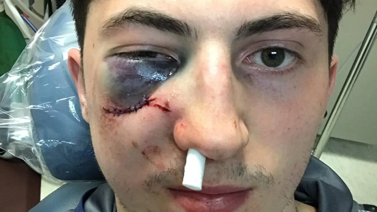 Columbus Blue Jackets place Zach Werenski on injured reserve - Article News sur NHL Insight